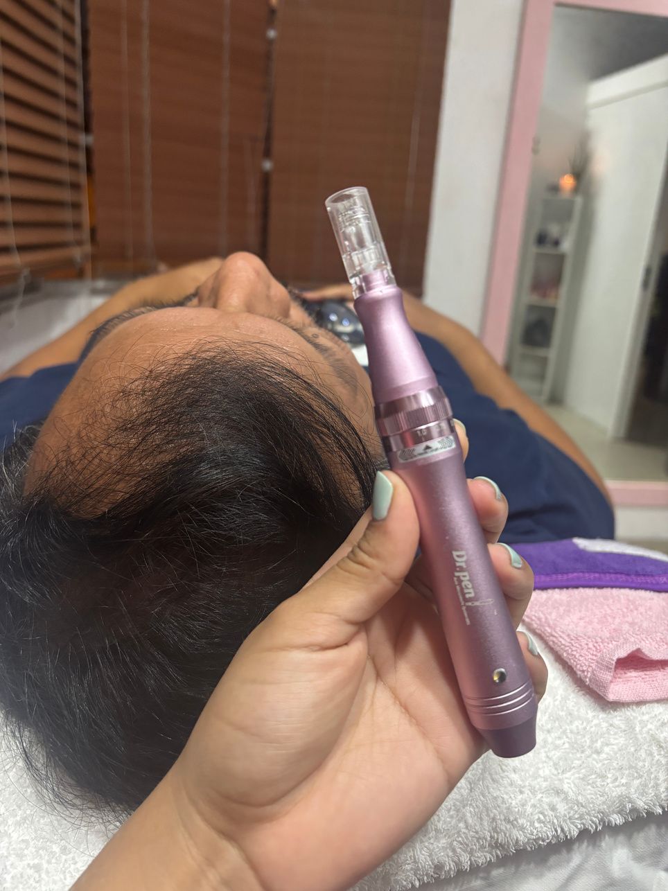 Mano de Ambar con un dermapen junto al rostro de una clienta