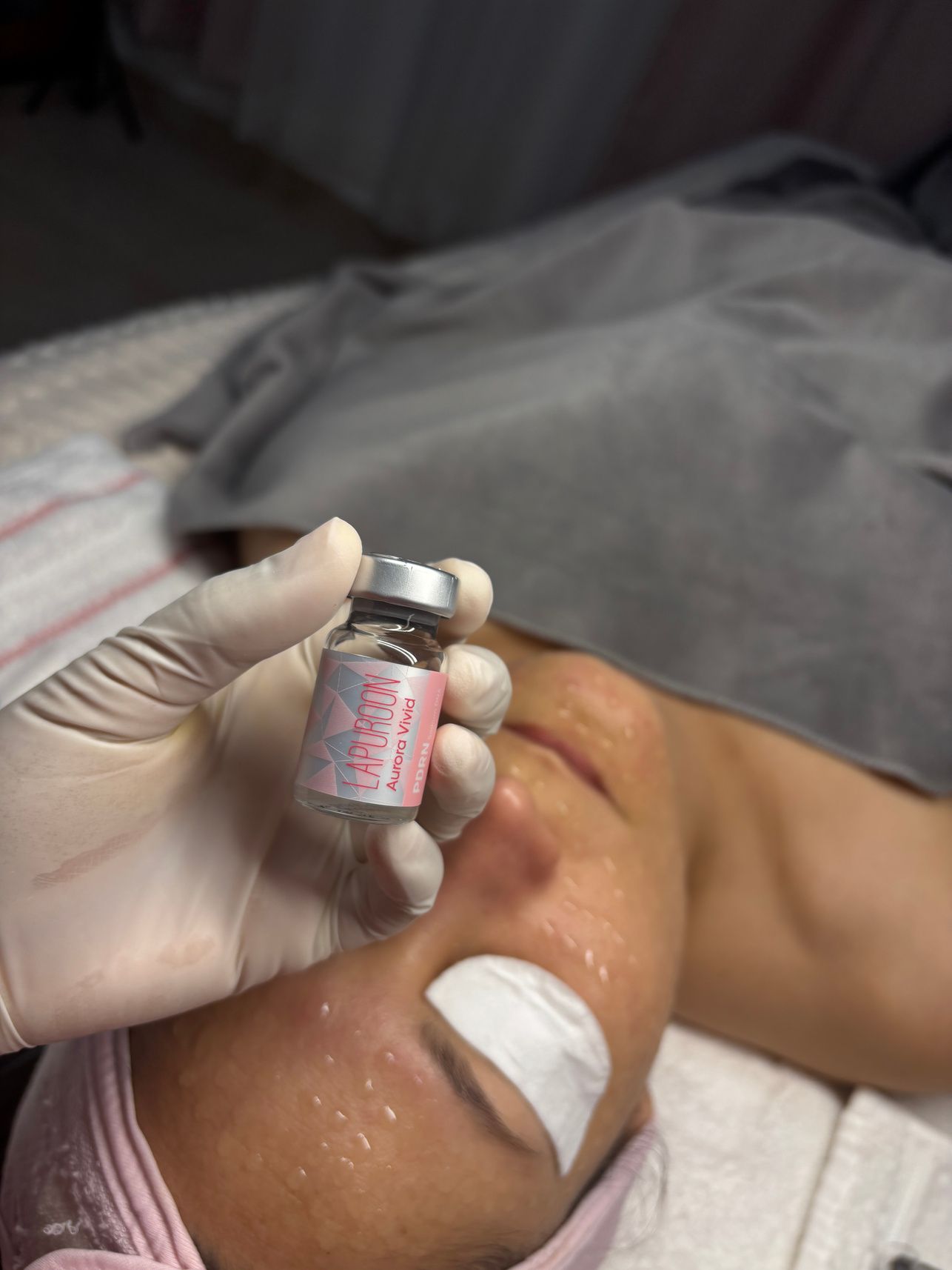 Vial de PDRN y dermapen junto al rostro de una clienta